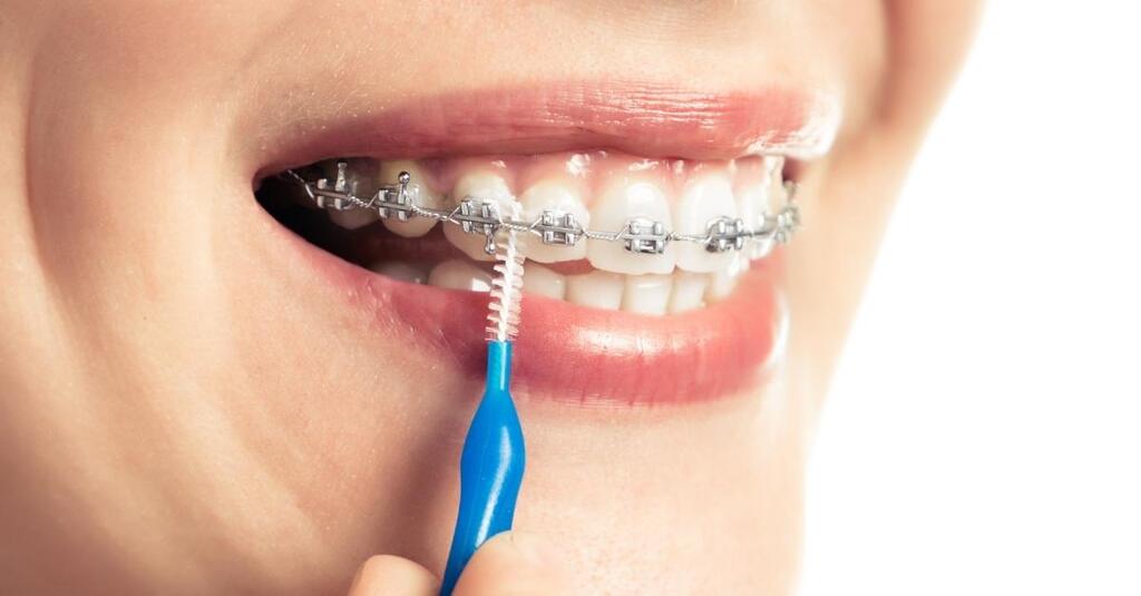 Dr Babyigit orthodontiste Strasbourg hygiène dentaire avec un appareil